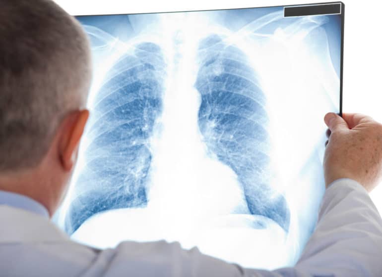 corsi ecm per fisioterapisti la diagnostica per immagini in riabilitazione