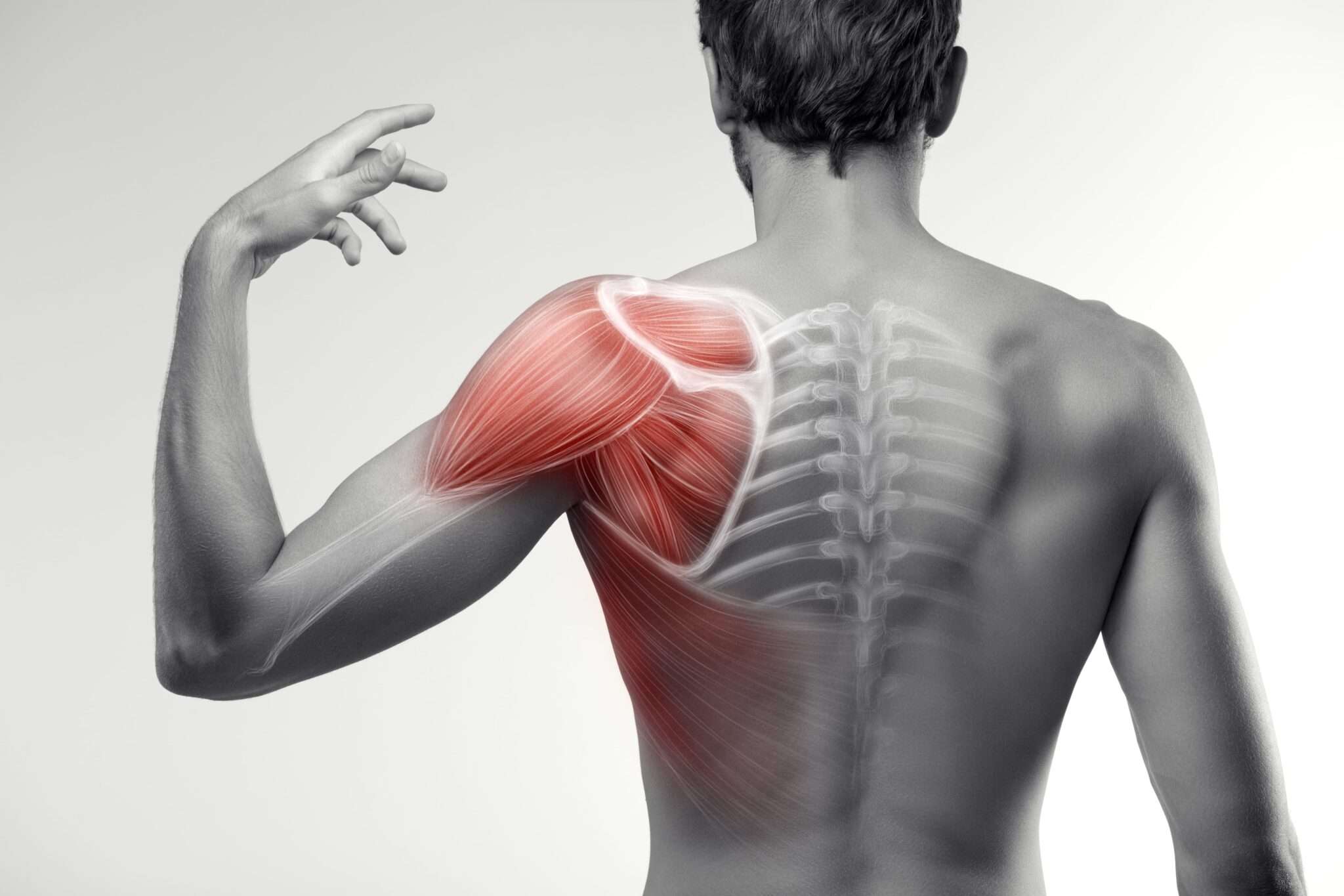 La spalla valutazione clinica e trattamento riabilitativo